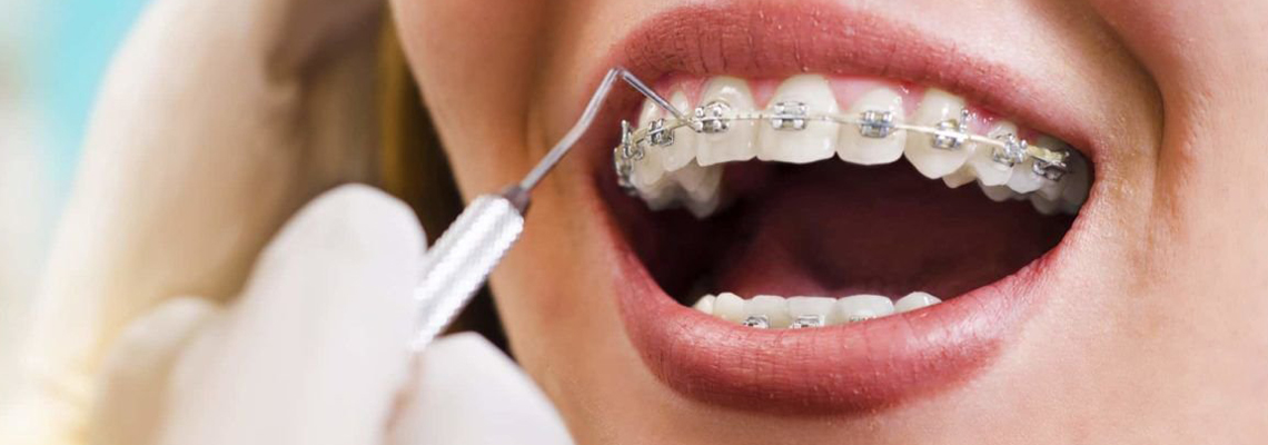 traitement orthodontique